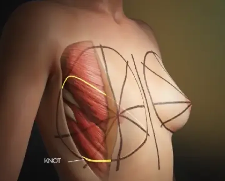 Animations 3D Médicale