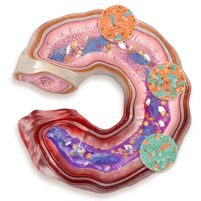 Phileo- intestin de poule Pathologie clostridium