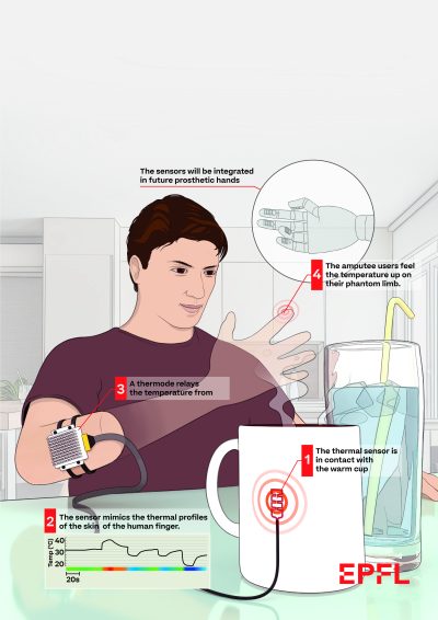 Amputee Feels with Bionic Hand - EPFL