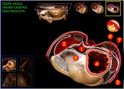 CDROM médical sur la chirurgie Digestive. coupe cranio caudale