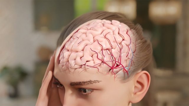 Film d'animation 3D — Eptinezumab