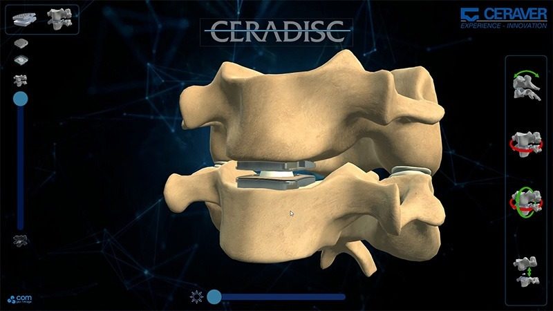 Ceraver — Ceradisc