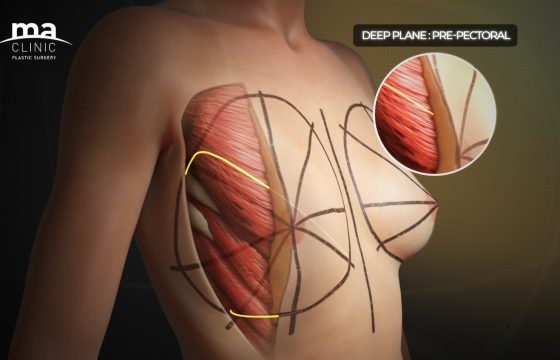 MA Clinic Plastic Surgery